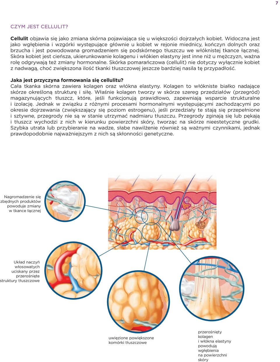 łącznej. Skóra kobiet jest cieńsza, ukierunkowanie kolagenu i włókien elastyny jest inne niż u mężczyzn, ważna rolę odgrywają też zmiany hormonalne.