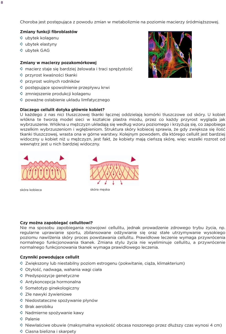 wolnych rodników postępujące spowolnienie przepływu krwi zmniejszenie produkcji kolagenu poważne osłabienie układu limfatycznego Dlaczego cellulit dotyka głównie kobiet?