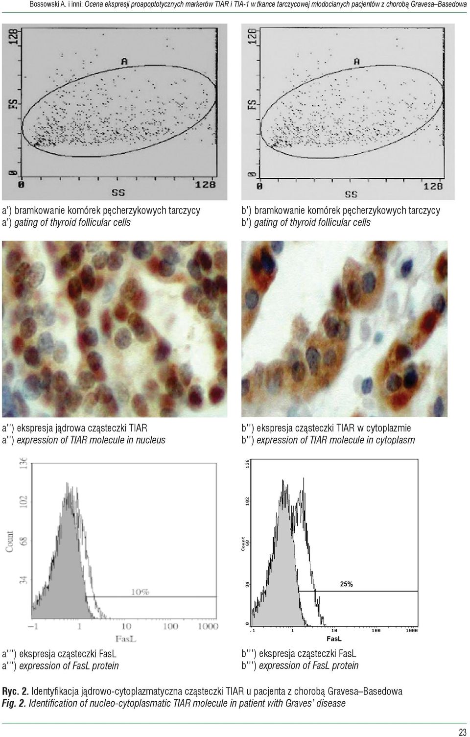 thyroid follicular cells b ) bramkowanie komórek pęcherzykowych tarczycy b ) gating of thyroid follicular cells a ) ekspresja jądrowa cząsteczki TIAR a ) expression of TIAR molecule in nucleus b )