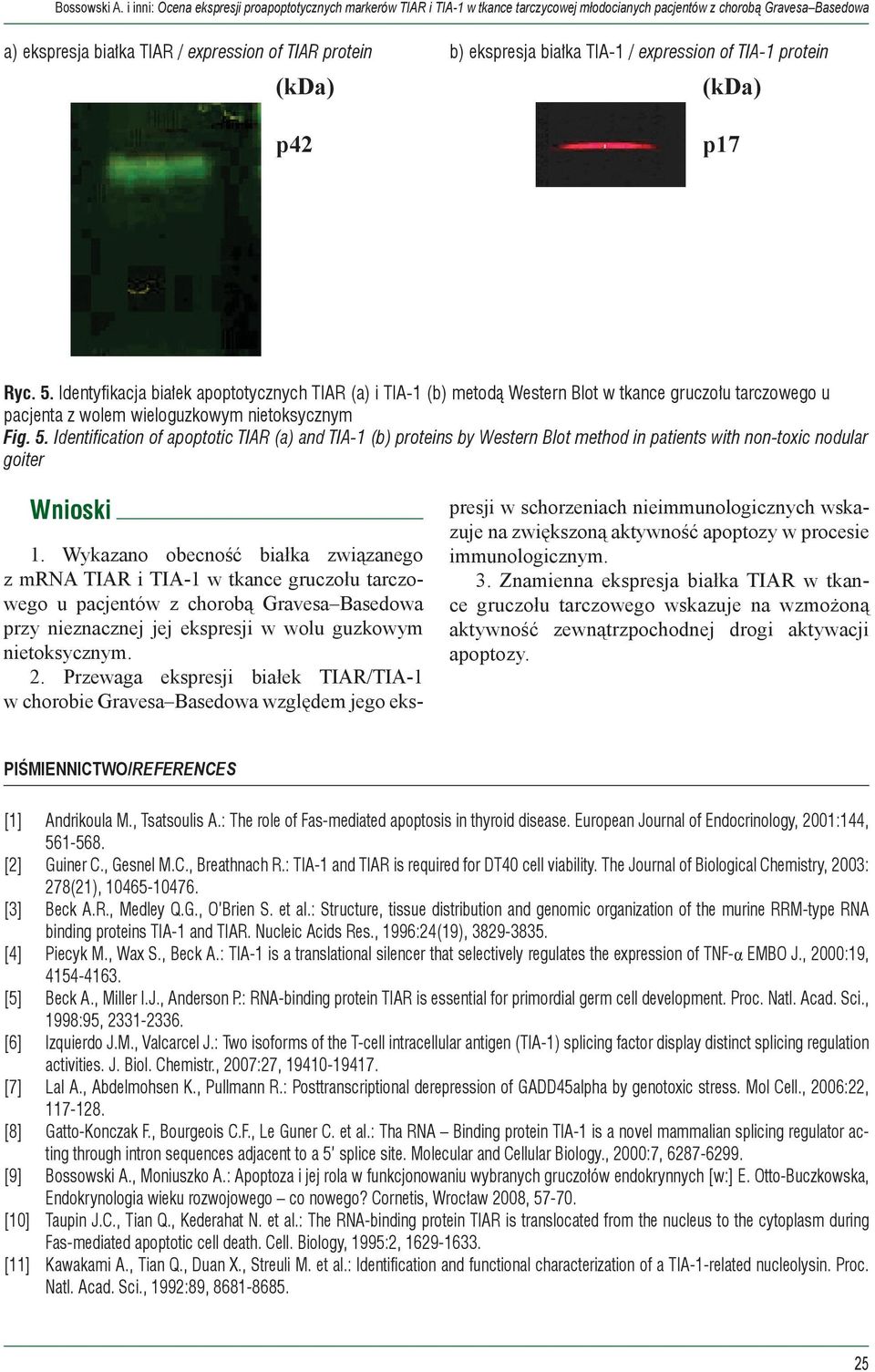 b) ekspresja białka TIA-1 / expression of TIA-1 protein (kda) p17 Ryc. 5.