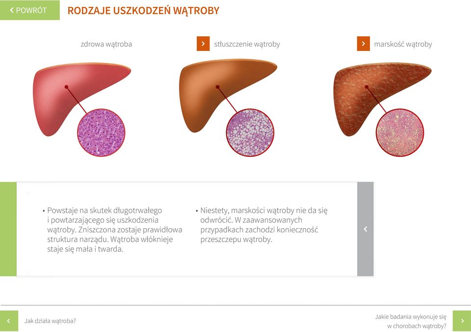 Jednak zbyt duże i powtarzające się uszkodzenia (przyczyną mogą być substancje hepatotoksyczne lub wirusy) prowadzą do zaburzeń w regeneracji, w wyniku