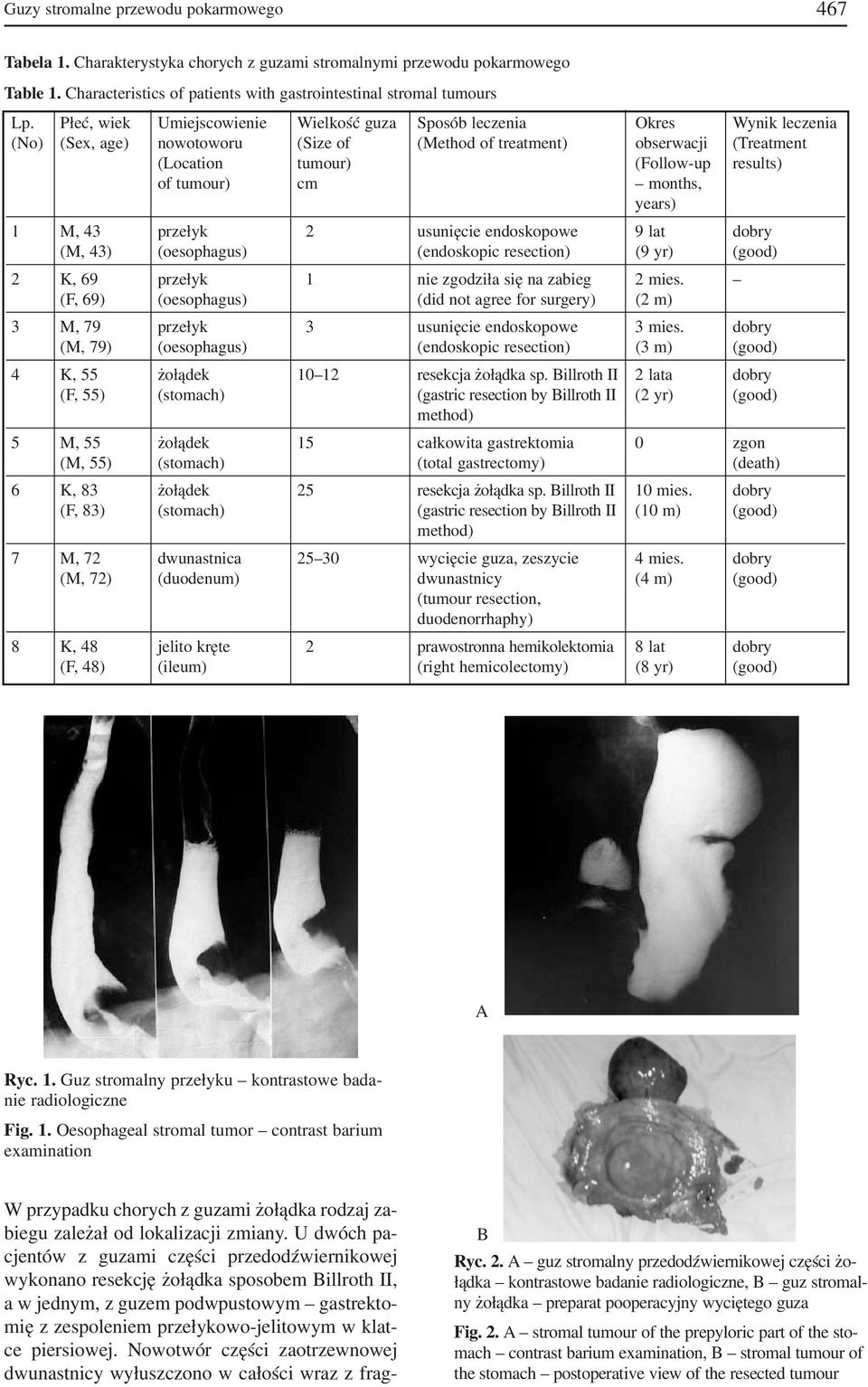 tumour) cm months, years) 1 M, 43 przełyk 2 usunięcie endoskopowe 9 lat dobry (M, 43) (oesophagus) (endoskopic resection) (9 yr) (good) 2 K, 69 przełyk 1 nie zgodziła się na zabieg 2 mies.