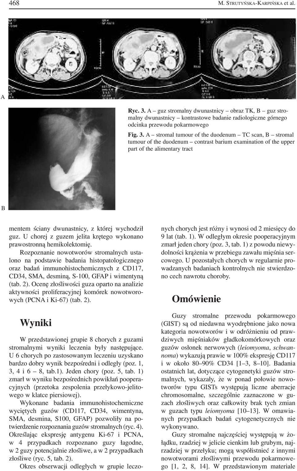 stromal tumour of the duodenum TC scan, stromal tumour of the duodenum contrast barium examination of the upper part of the alimentary tract mentem ściany dwunastnicy, z której wychodził guz.