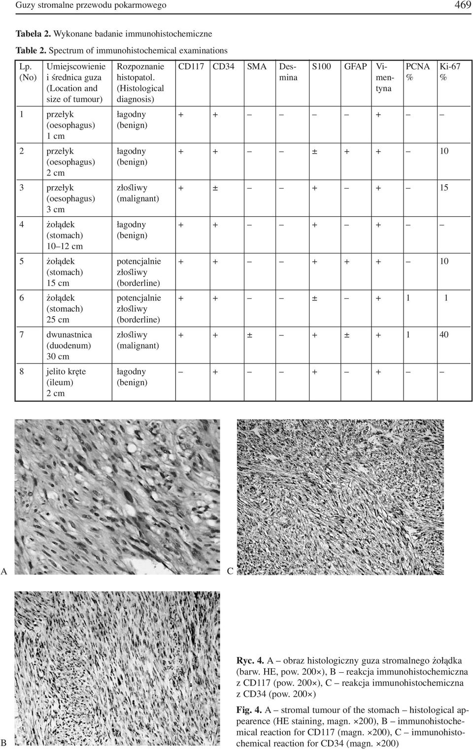 mina men % % (Location and (Histological tyna size of tumour) diagnosis) 1 przełyk łagodny + + + (oesophagus) (benign) 1 cm 2 przełyk łagodny + + ± + + 10 (oesophagus) (benign) 2 cm 3 przełyk