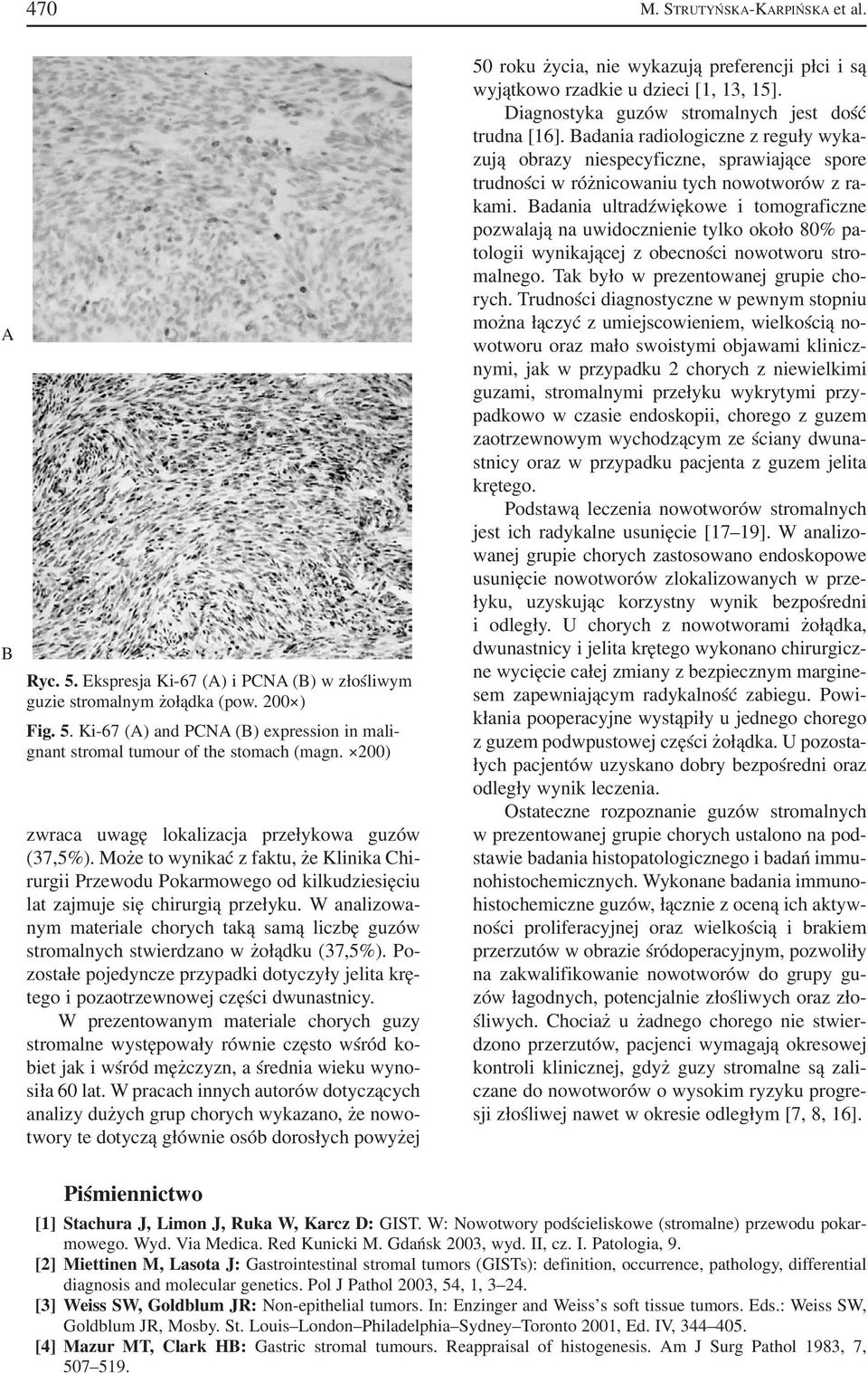 W analizowa nym materiale chorych taką samą liczbę guzów stromalnych stwierdzano w żołądku (37,5%). Po zostałe pojedyncze przypadki dotyczyły jelita krę tego i pozaotrzewnowej części dwunastnicy.