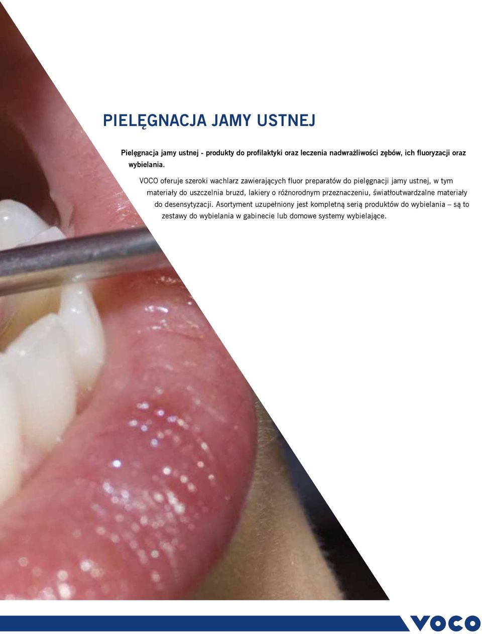 VOCO oferuje szeroki wachlarz zawierających fluor preparatów do pielęgnacji jamy ustnej, w tym materiały do uszczelnia