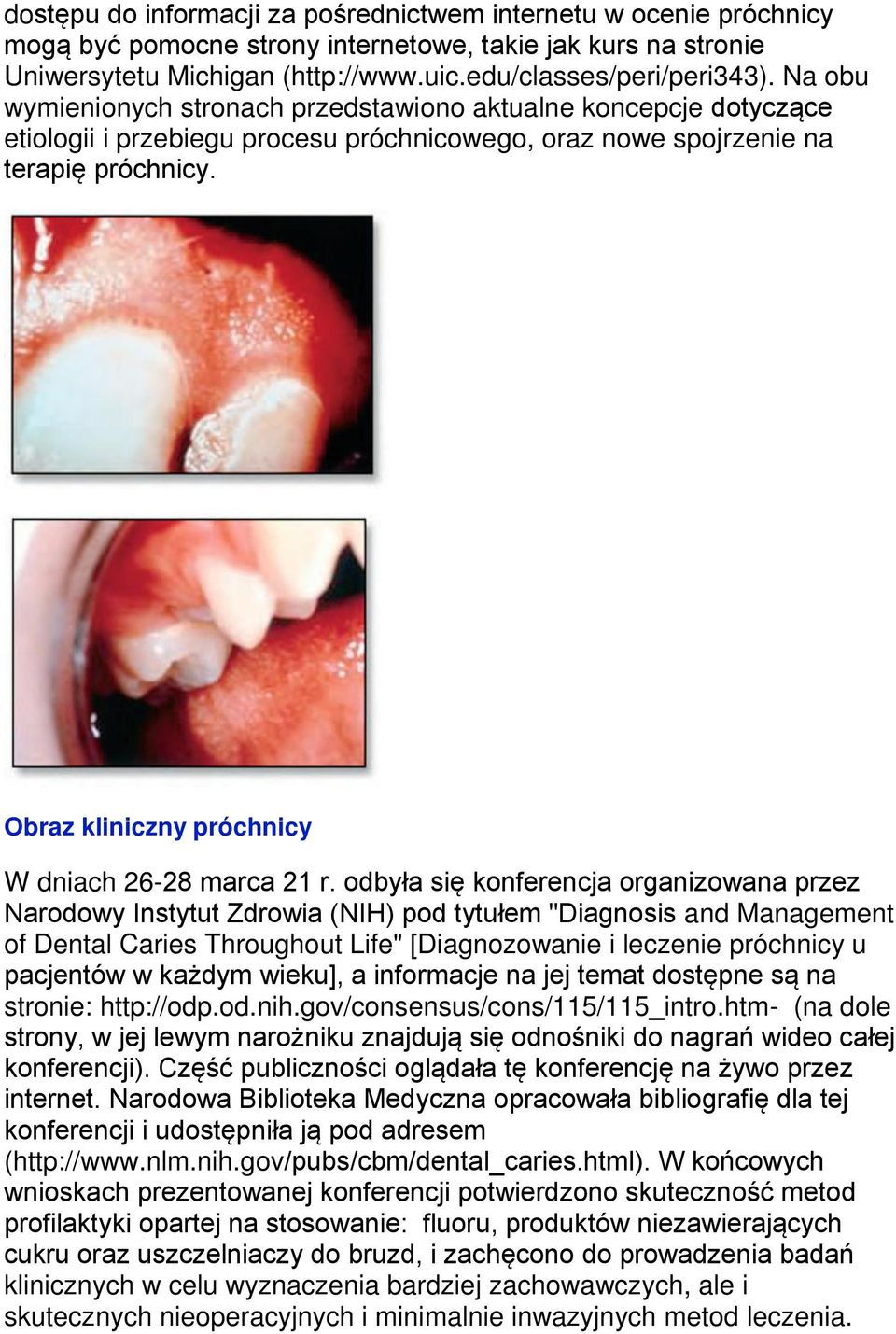 Obraz kliniczny próchnicy W dniach 26-28 marca 21 r.