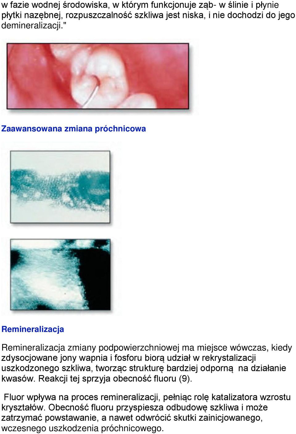 rekrystalizacji uszkodzonego szkliwa, tworząc strukturę bardziej odporną na działanie kwasów. Reakcji tej sprzyja obecność fluoru (9).