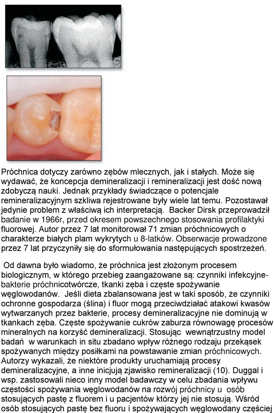Backer Dirsk przeprowadził badanie w 1966r, przed okresem powszechnego stosowania profilaktyki fluorowej.