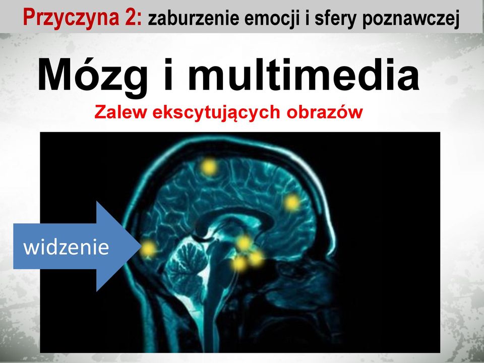 Mózg i multimedia Zalew