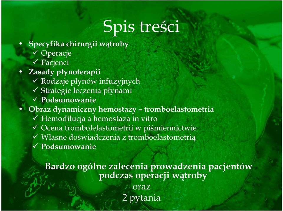 Hemodilucja a hemostaza in vitro Ocena trombolelastometrii w piśmiennictwie Własne doświadczenia z