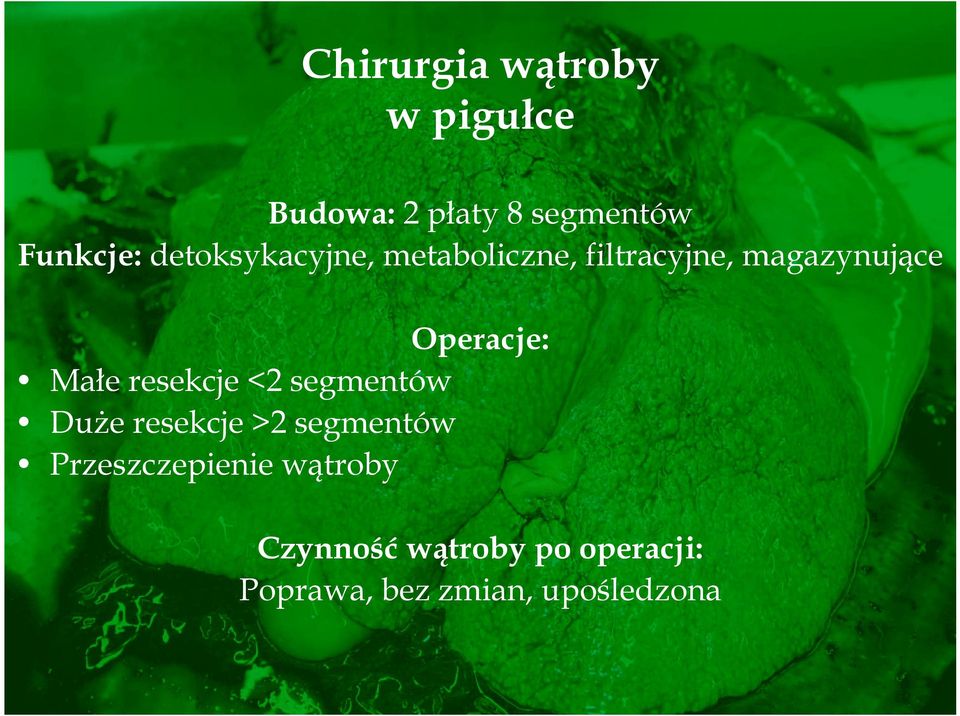 Małe resekcje <2 segmentów Duże resekcje >2 segmentów