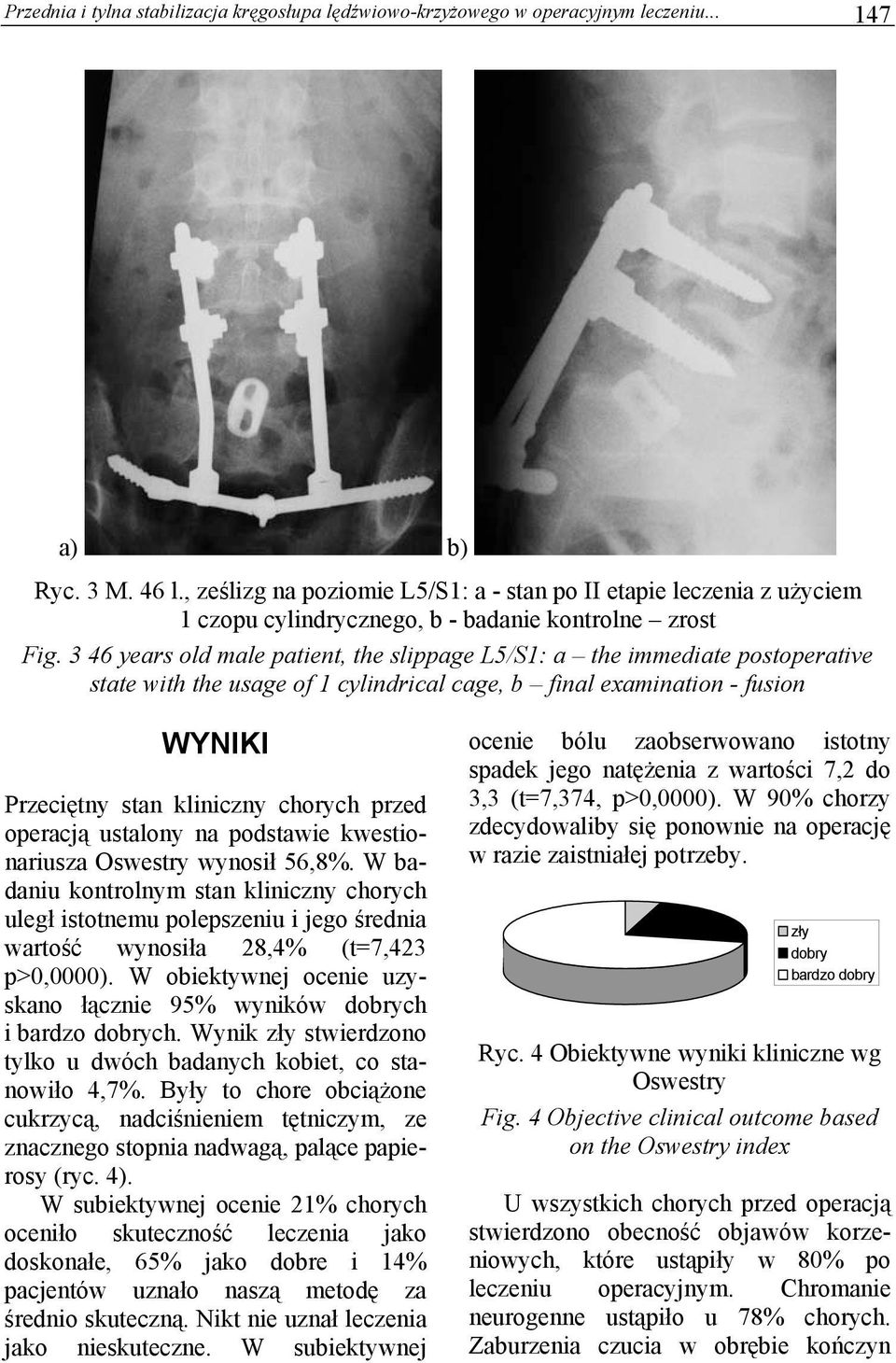 3 46 years old male patient, the slippage L5/S1: a the immediate postoperative state with the usage of 1 cylindrical cage, b final examination - fusion WYNIKI Przeciętny stan kliniczny chorych przed