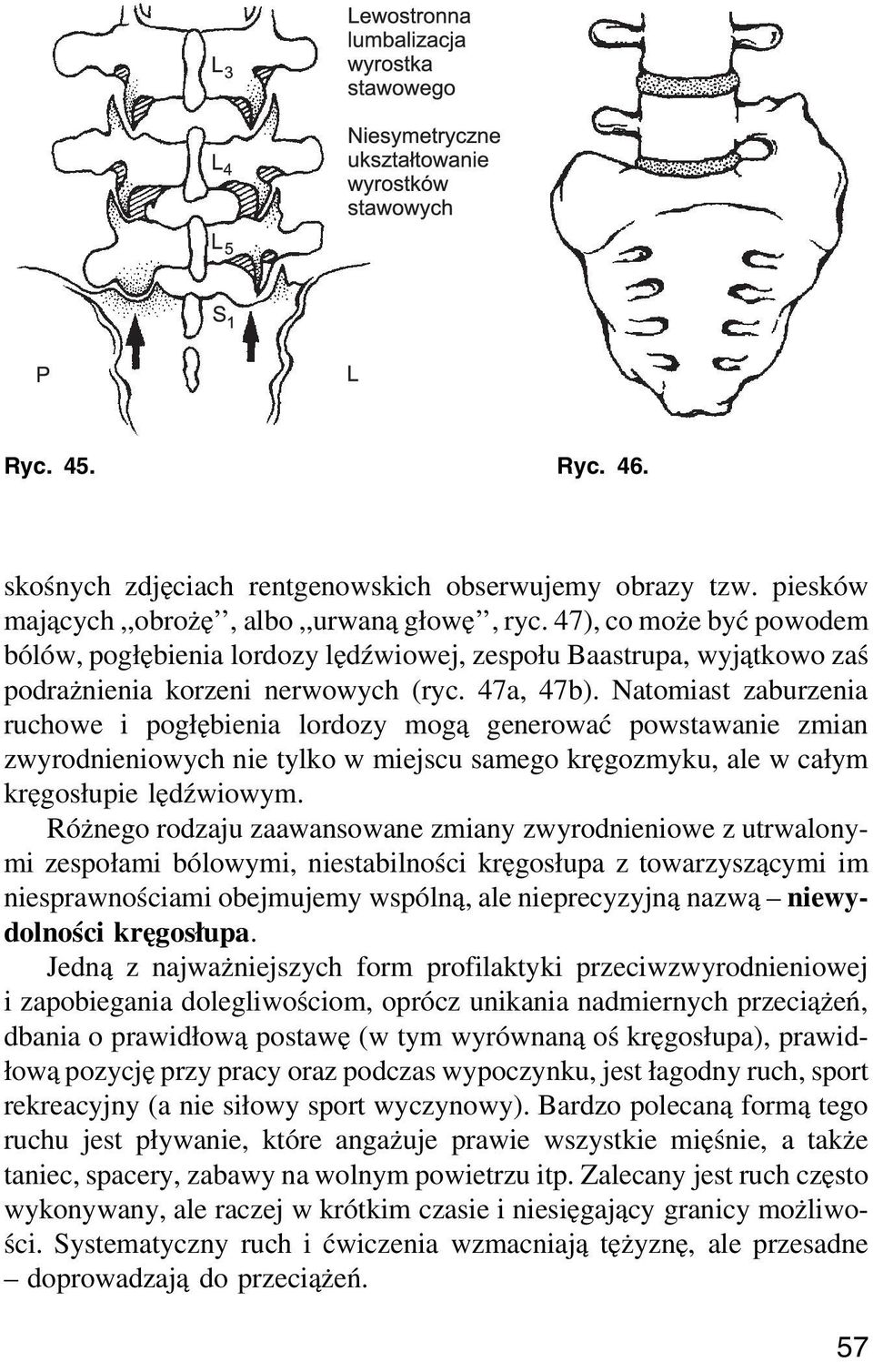 Natomiast zaburzenia ruchowe i pogłębienia lordozy mogą generować powstawanie zmian zwyrodnieniowych nie tylko w miejscu samego kręgozmyku, ale w całym kręgosłupie lędźwiowym.