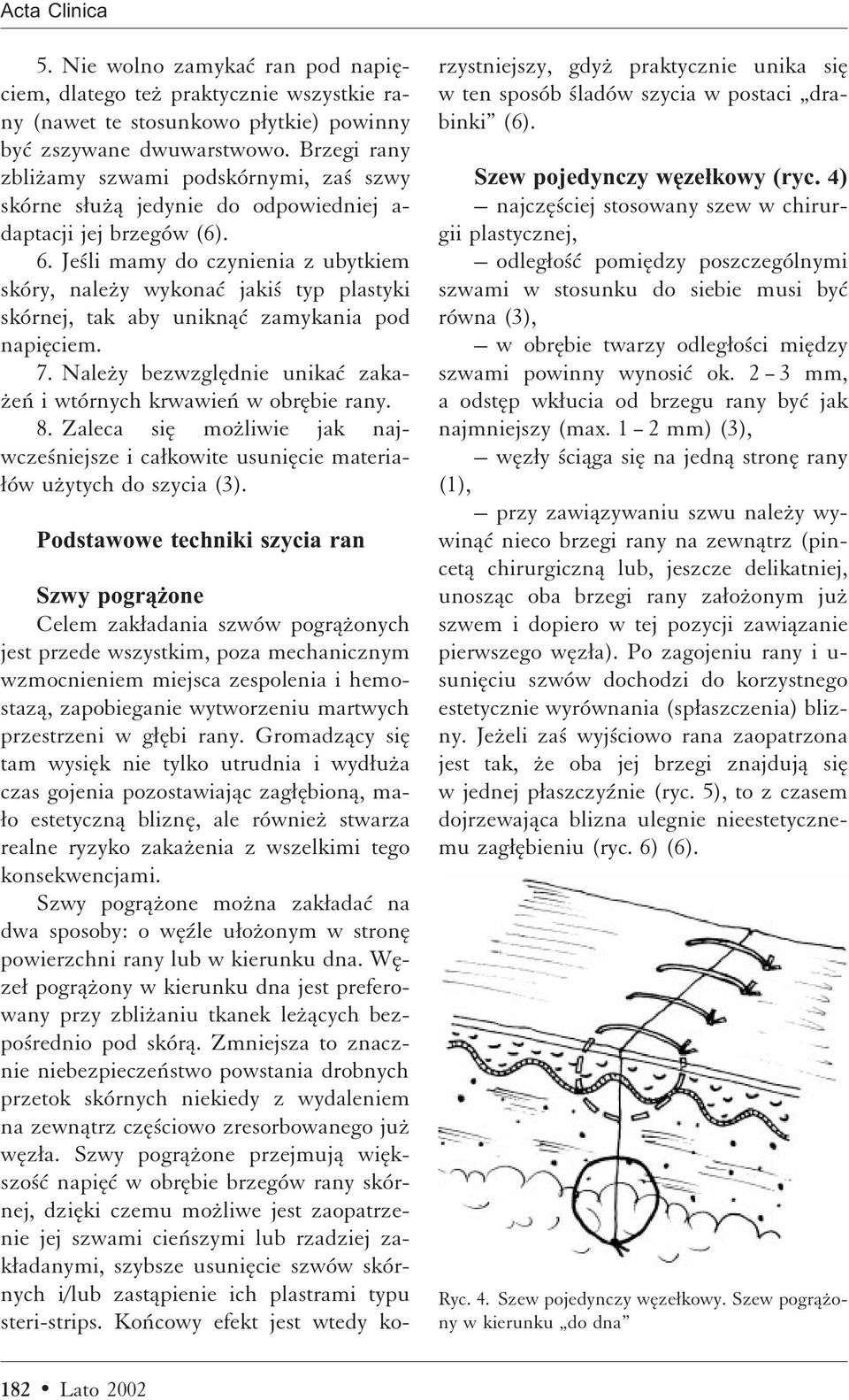 Je li mamy do czynienia z ubytkiem skóry, naleºy wykonaì jaki typ plastyki skórnej, tak aby uniknåì zamykania pod napiæciem. 7. Naleºy bezwzglædnie unikaì zaka- ºeñ i wtórnych krwawieñ w obræbie rany.