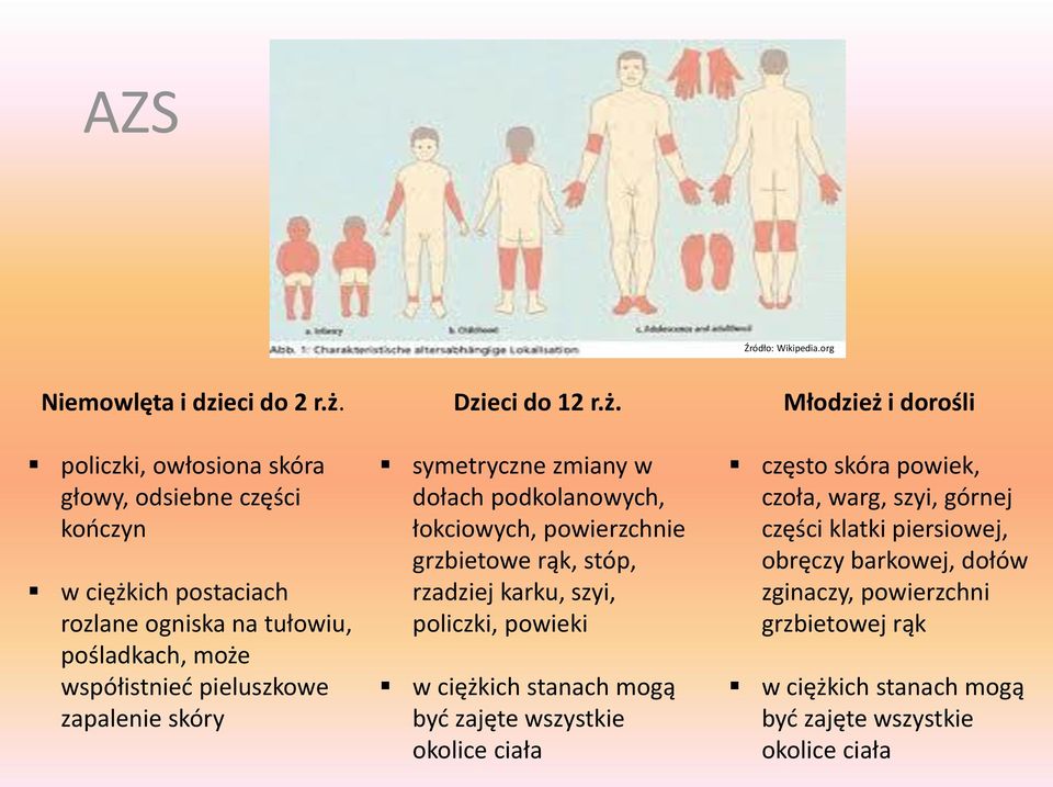 skóry Dzieci do 12 r.ż.