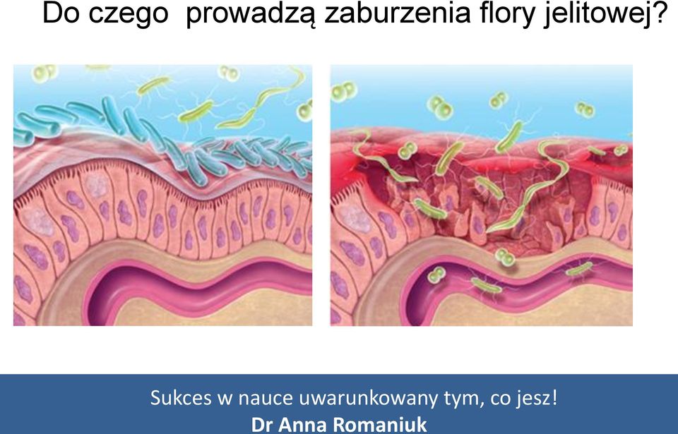 zaburzenia