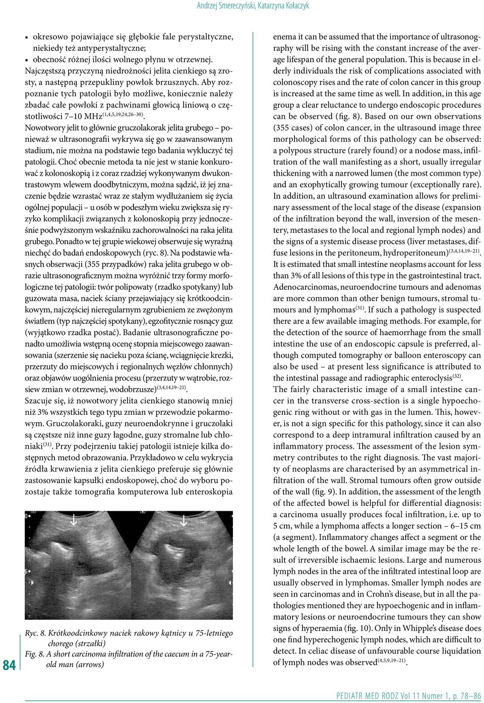 Aby rozpoznanie tych patologii było możliwe, koniecznie należy zbadać całe powłoki z pachwinami głowicą liniową o częstotliwości 7 10 MHz (1,4,5,19,24,26 30).