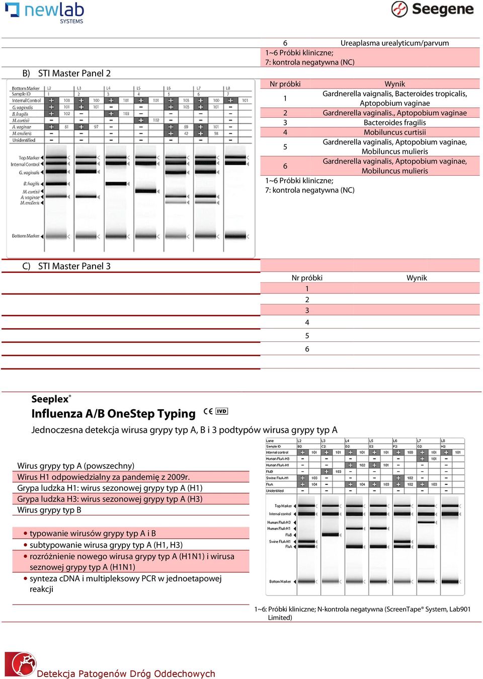 , Aptopobium vaginae 3 Bacteroides fragilis 4 Mobiluncus curtisii Gardnerella vaginalis, Aptopobium vaginae, 5 6 1~6 Próbki kliniczne; 7: kontrola negatywna (NC) Mobiluncus mulieris Gardnerella