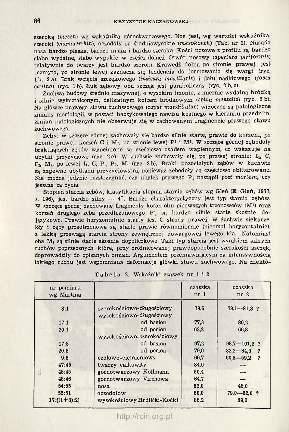 Otwór nosowy (apertura piriformis) relatywnie do twarzy jest bardzo szeroki. Krawędź dolna po stronie prawej jest rozmyta, po stronie lewej zaznacza się tendencja do formowania się wargi (ryc.