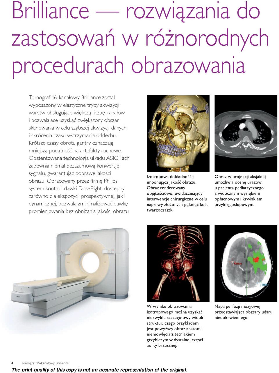 Opatentowana technologia układu ASIC Tach zapewnia niemal bezszumową konwersję sygnału, gwarantując poprawę jakości obrazu.