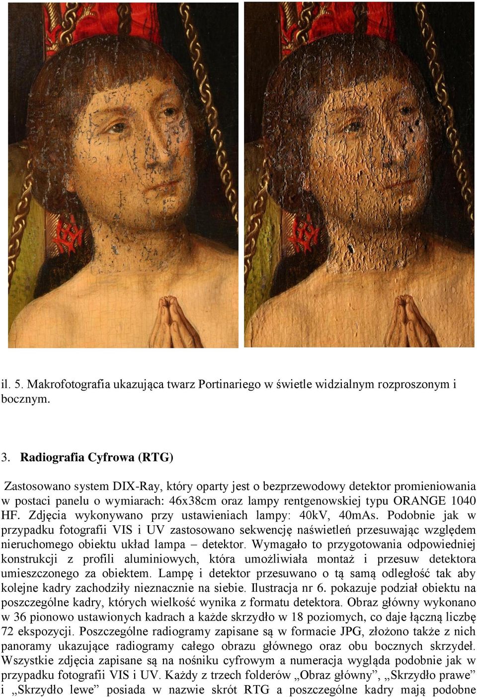 Zdjęcia wykonywano przy ustawieniach lampy: 40kV, 40mAs. Podobnie jak w przypadku fotografii VIS i UV zastosowano sekwencję naświetleń przesuwając względem nieruchomego obiektu układ lampa detektor.