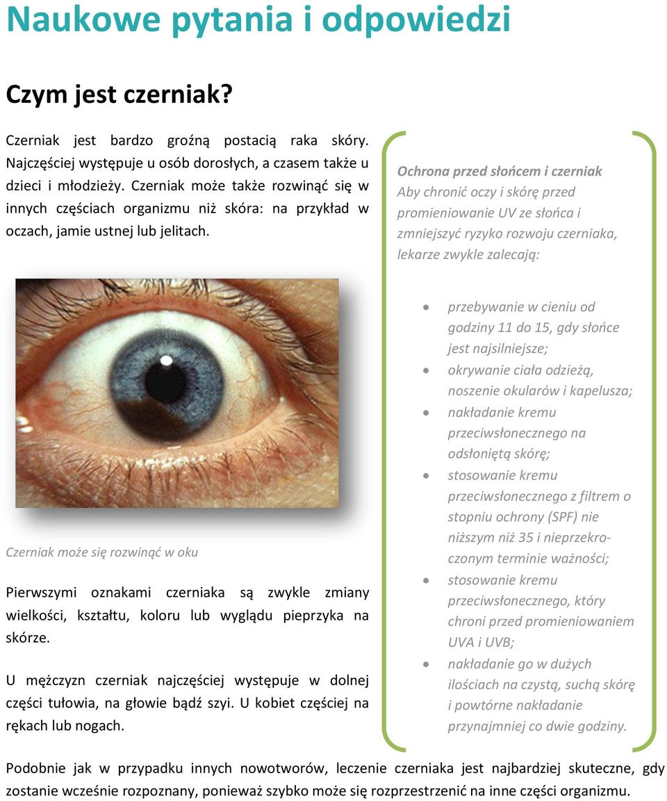 Ochrona przed słońcem i czerniak Aby chronić oczy i skórę przed promieniowanie UV ze słońca i zmniejszyć ryzyko rozwoju czerniaka, lekarze zwykle zalecają: Czerniak może się rozwinąć w oku Pierwszymi
