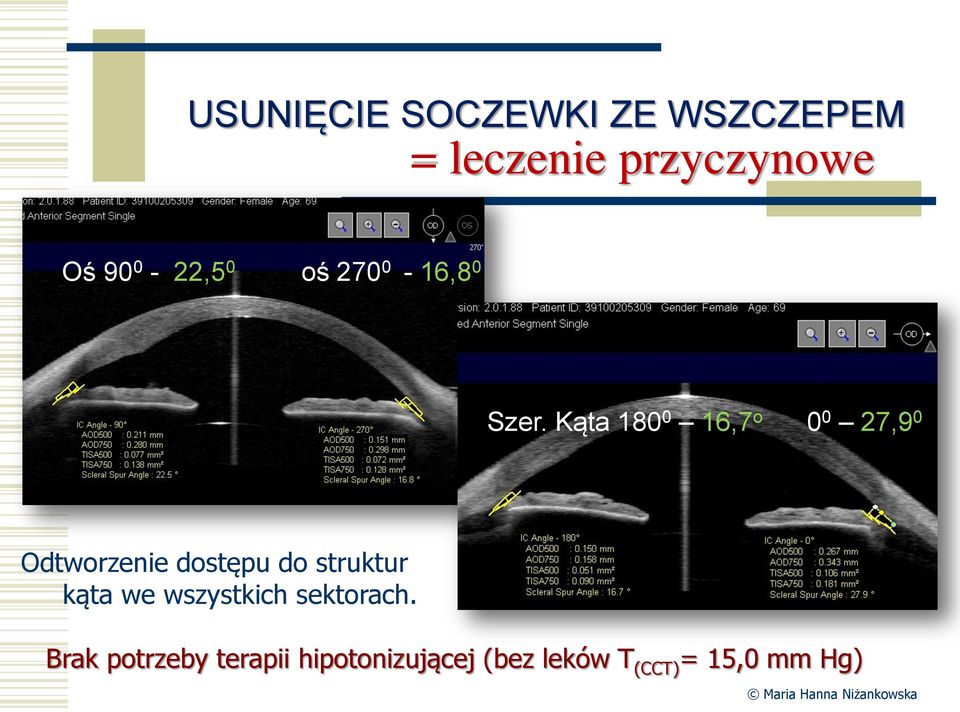 Kąta 180 0 16,7 o 0 0 27,9 0 Odtworzenie dostępu do struktur