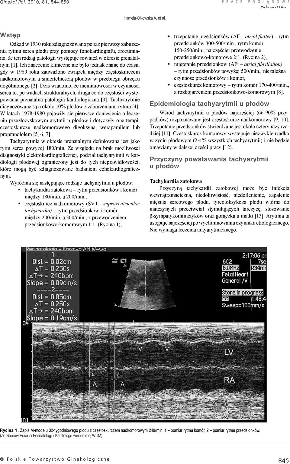 Ich znaczenie kliniczne nie było jednak znane do czasu, gdy w 1969 roku zauważono związek między częstoskurczem nadkomorowym a śmiertelnością płodów w przebiegu obrzęku uogólnionego [2].