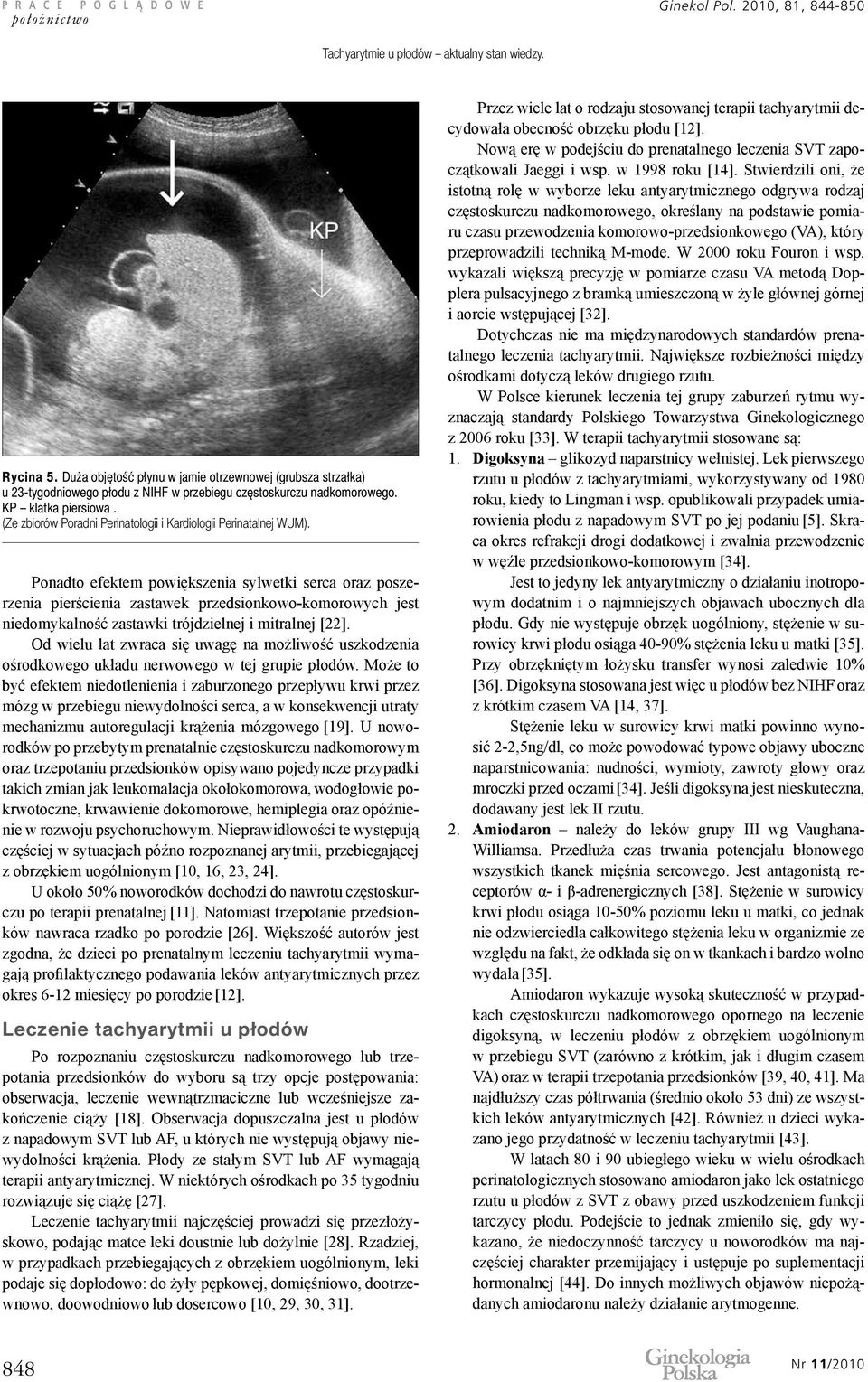 (Ze zbiorów Poradni Perinatologii i Kardiologii Perinatalnej WUM).