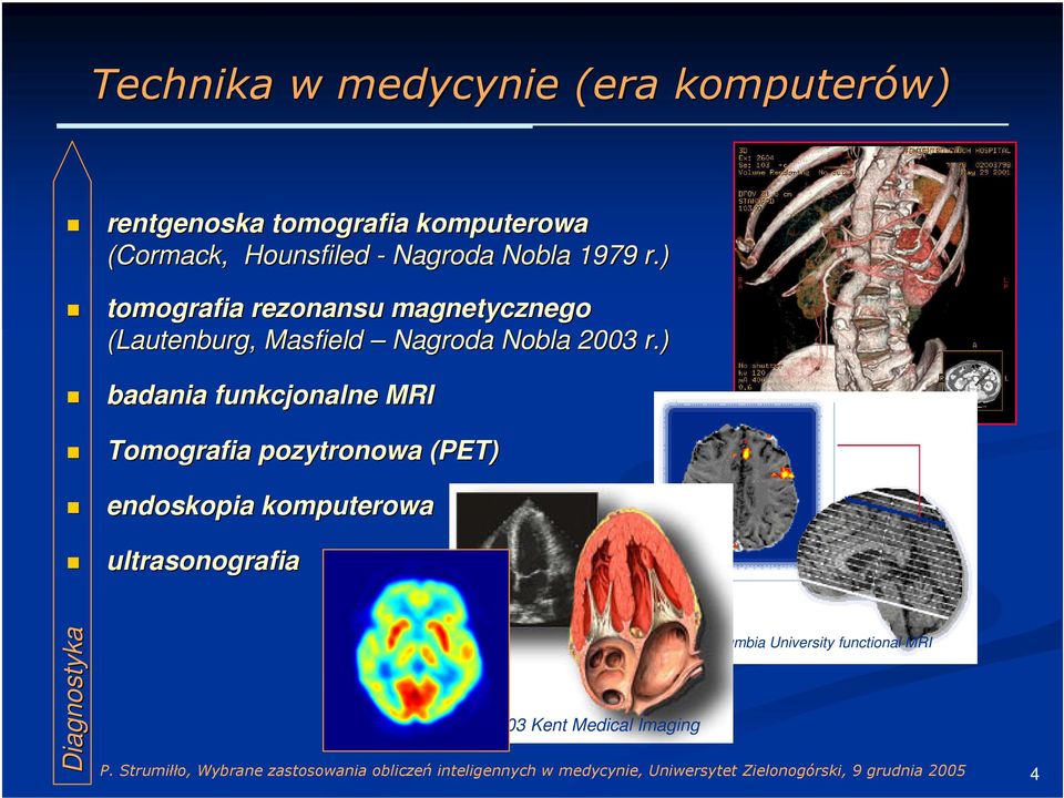 ) tomografia rezonansu magnetycznego (Lautenburg, Masfield Nagroda Nobla 2003 r.