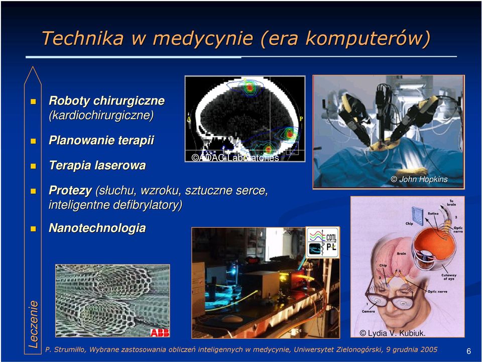 Laboratories Protezy (słuchu, wzroku, sztuczne serce,