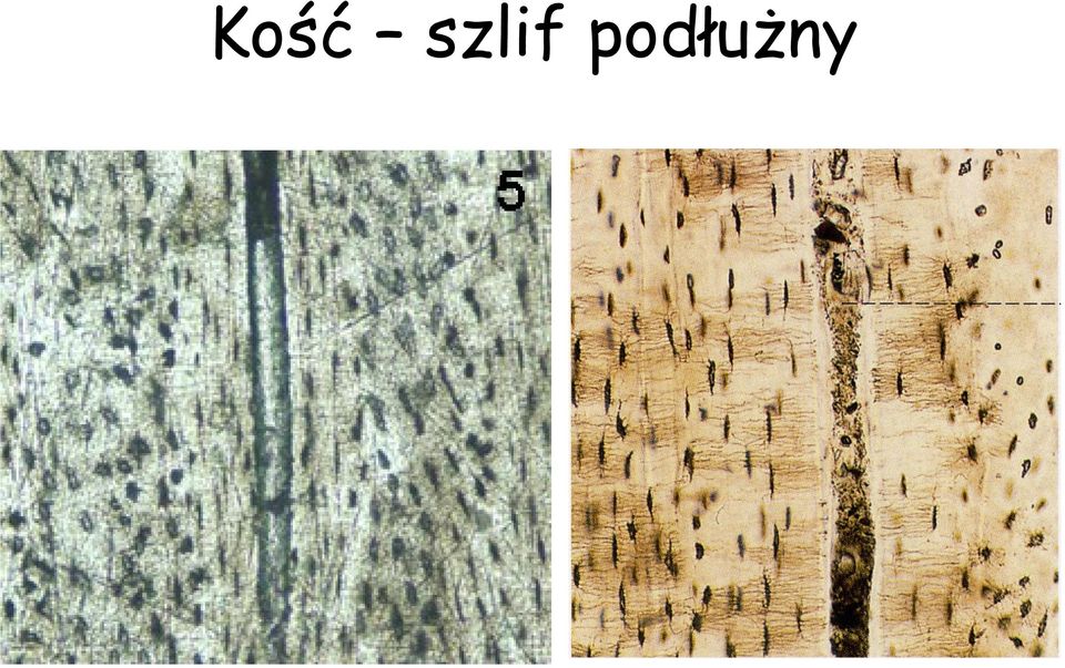 podłużny