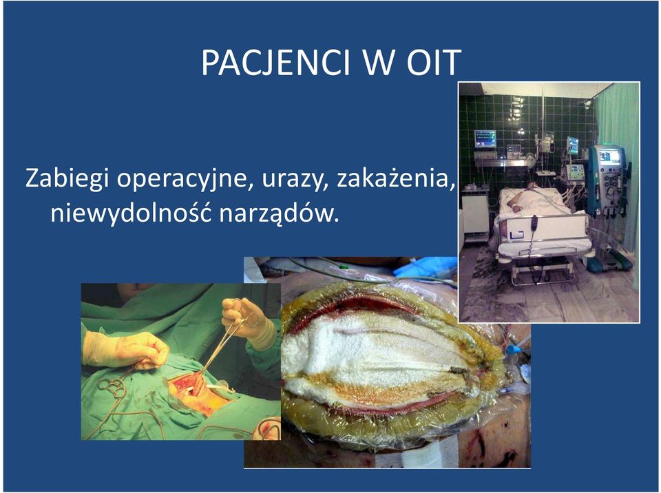 operacyjne, urazy,