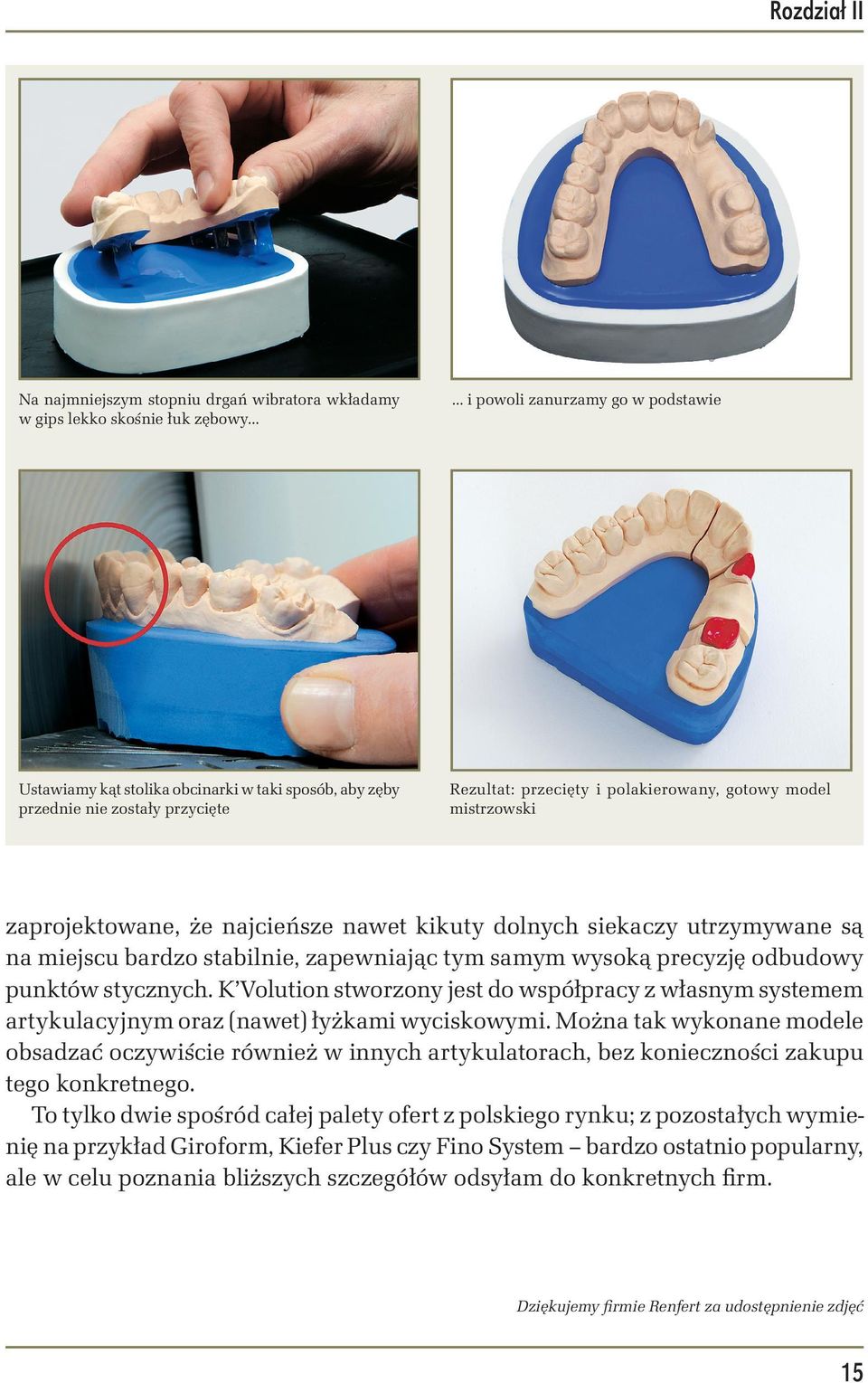 zaprojektowane, że najcieńsze nawet kikuty dolnych siekaczy utrzymywane są na miejscu bardzo stabilnie, zapewniając tym samym wysoką precyzję odbudowy punktów stycznych.