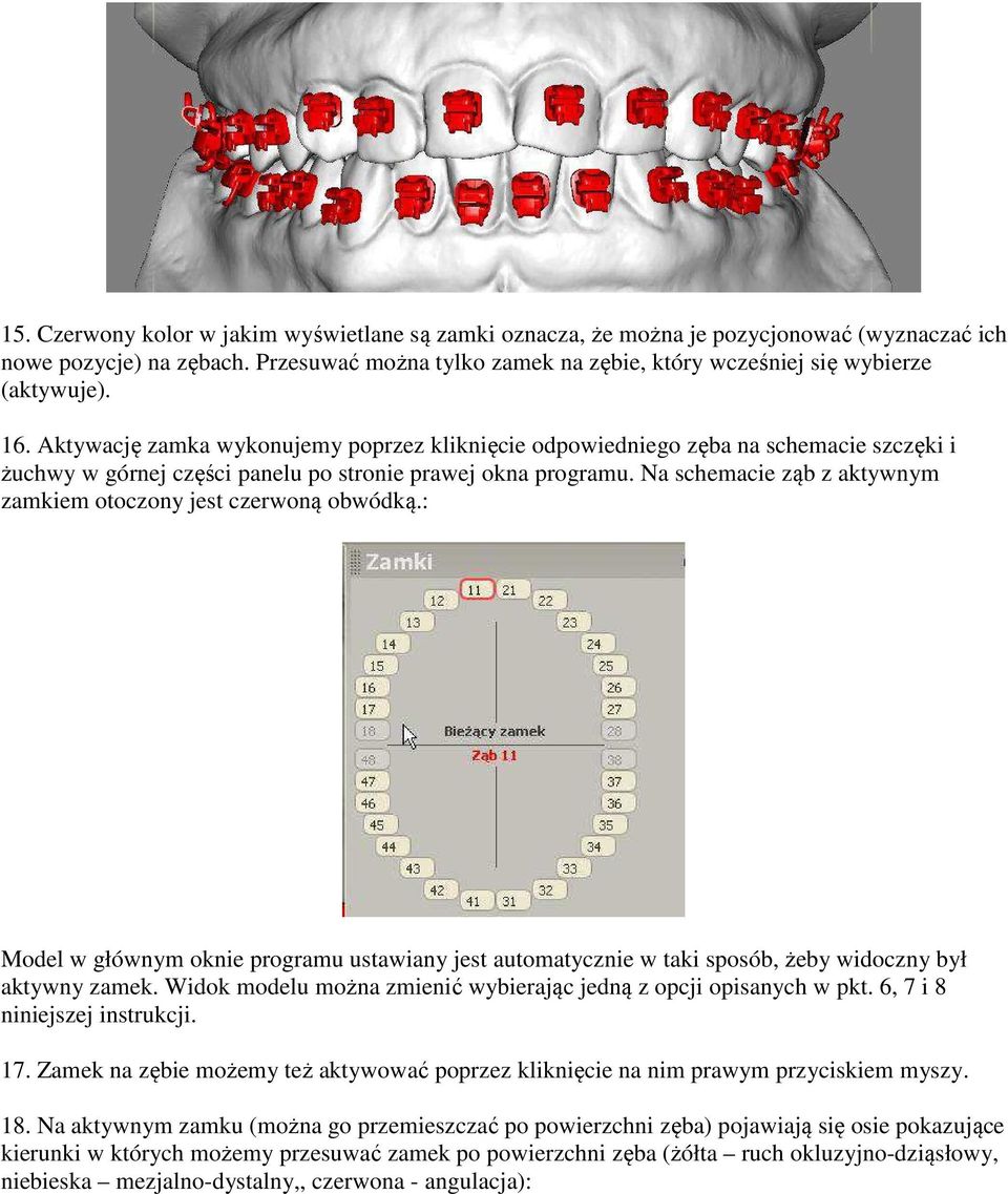 Na schemacie ząb z aktywnym zamkiem otoczony jest czerwoną obwódką.: Model w głównym oknie programu ustawiany jest automatycznie w taki sposób, żeby widoczny był aktywny zamek.