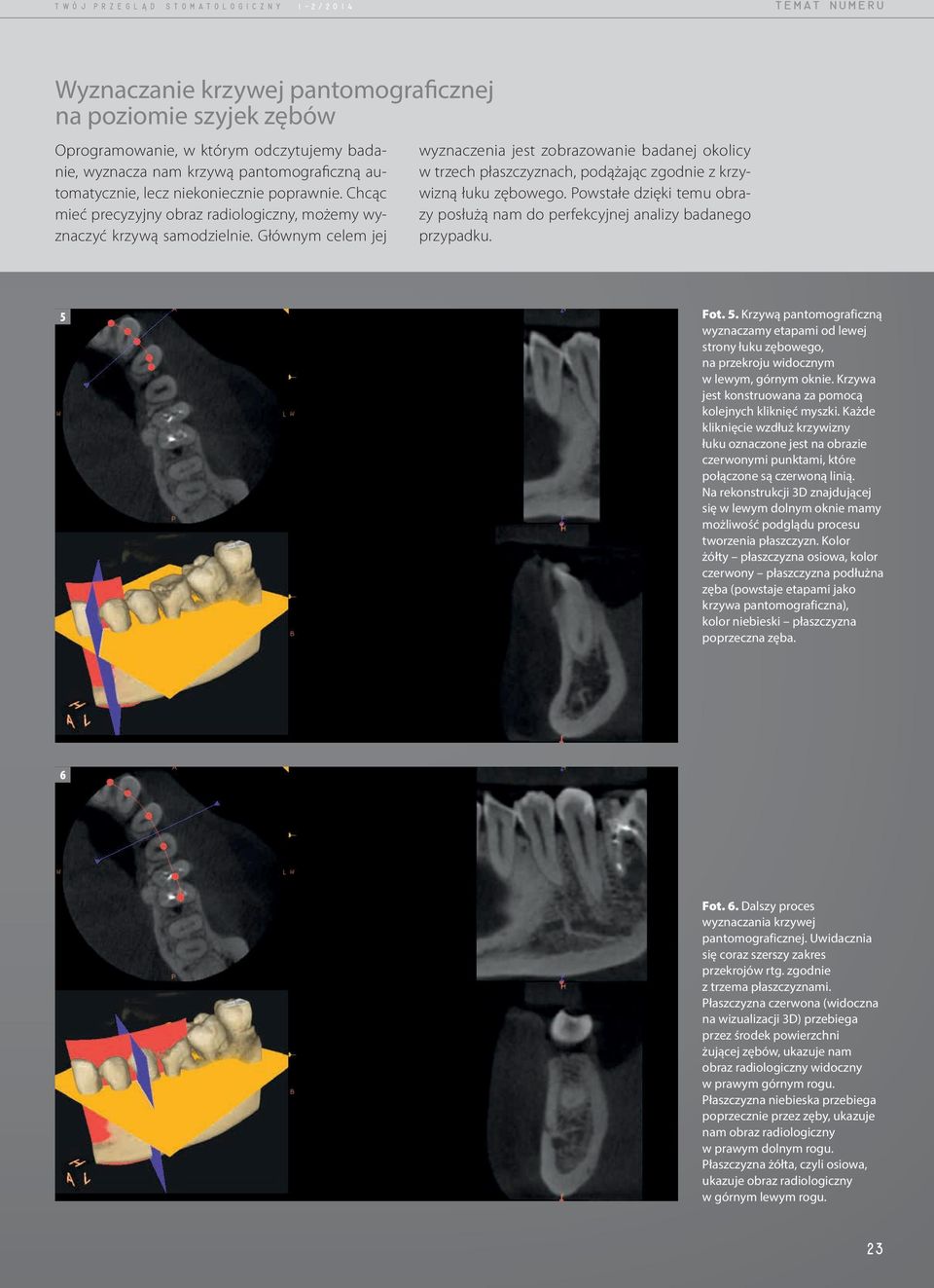 Zastosowanie Tomografii Stożkowej Cbct We Współczesnej Endodoncji Pdf Free Download 1477