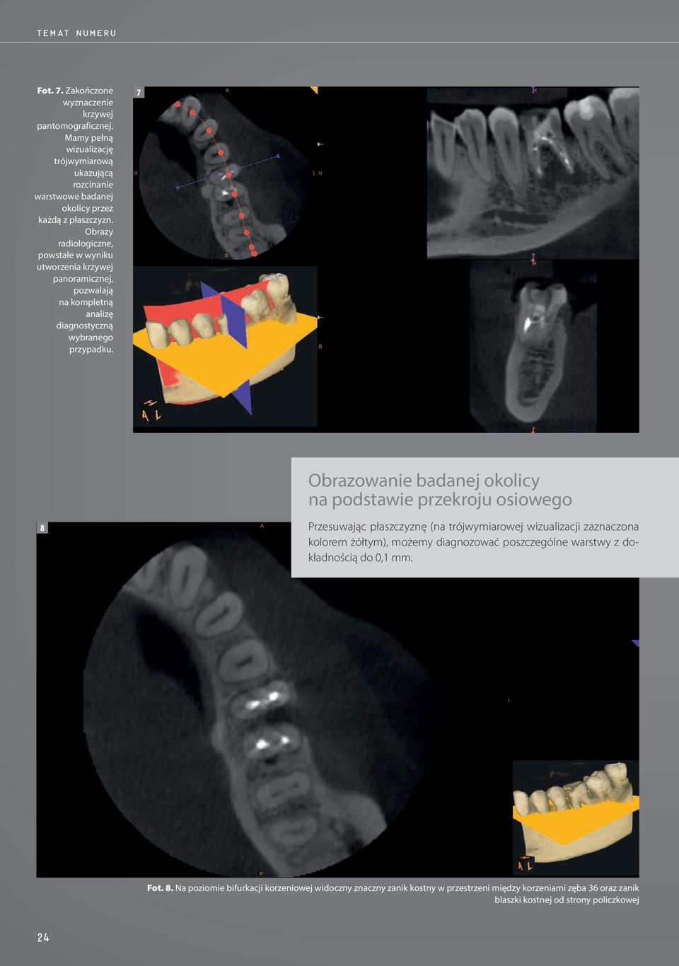 Obrazy radiologiczne, powstałe w wyniku utworzenia krzywej panoramicznej, pozwalają na kompletną analizę diagnostyczną wybranego przypadku.