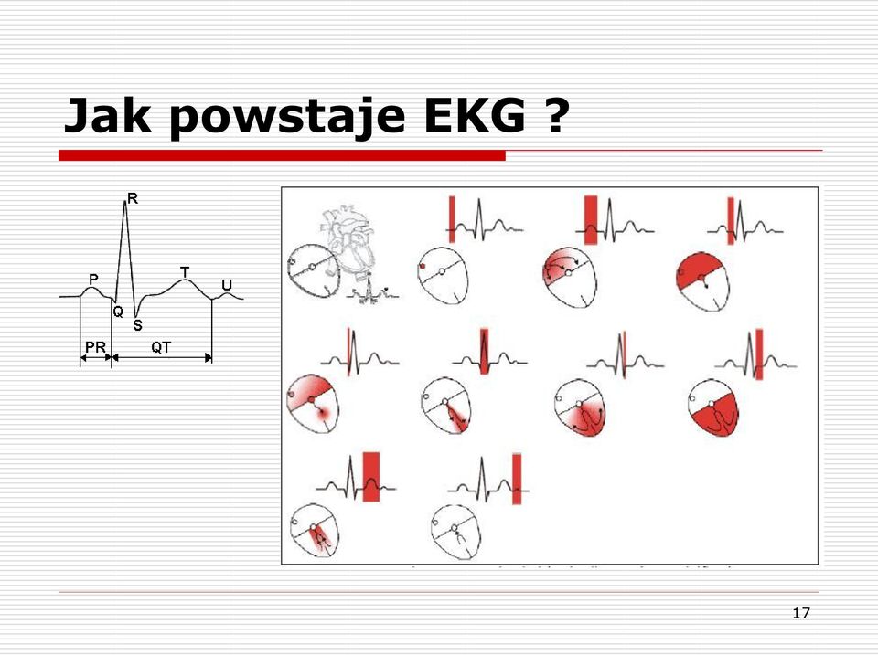 EKG? 17