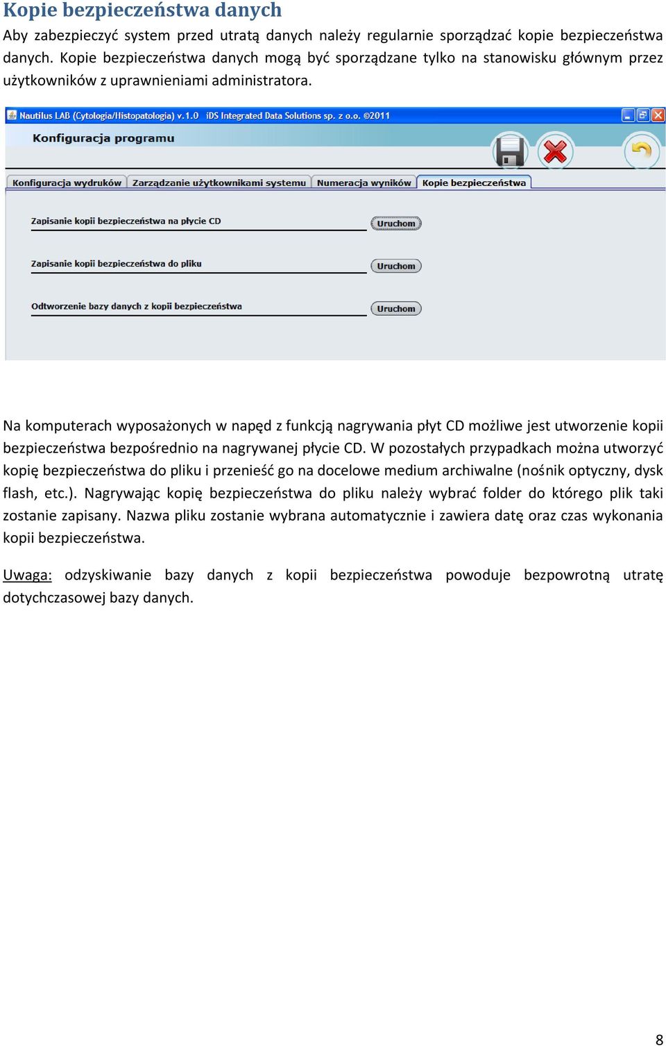 Na komputerach wyposażonych w napęd z funkcją nagrywania płyt CD możliwe jest utworzenie kopii bezpieczeństwa bezpośrednio na nagrywanej płycie CD.