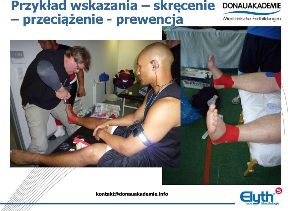 skręcenie