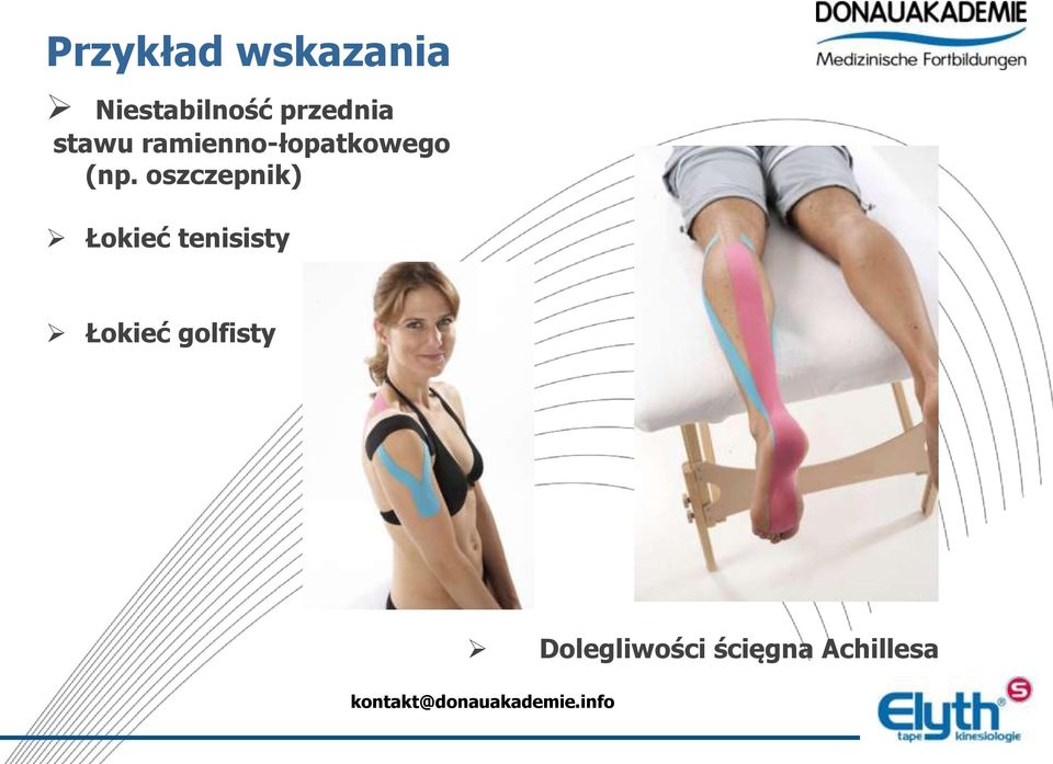 (np. oszczepnik) Łokieć tenisisty