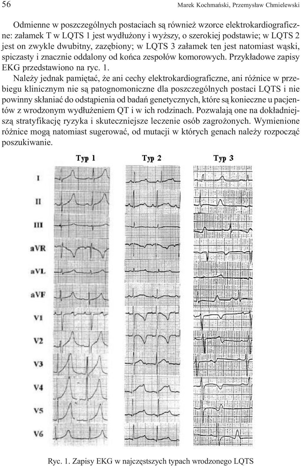 Nale y jednak pamiêtaæ, e ani cechy elektrokardiograficzne, ani ró nice w przebiegu klinicznym nie s¹ patognomoniczne dla poszczególnych postaci LQTS i nie powinny sk³aniaæ do odst¹pienia od badañ