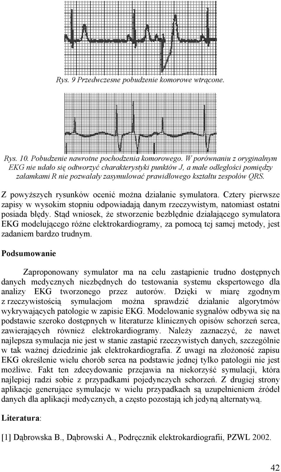 Z powyższych rysunków ocenić można działanie symulatora. Cztery pierwsze zapisy w wysokim stopniu odpowiadają danym rzeczywistym, natomiast ostatni posiada błędy.