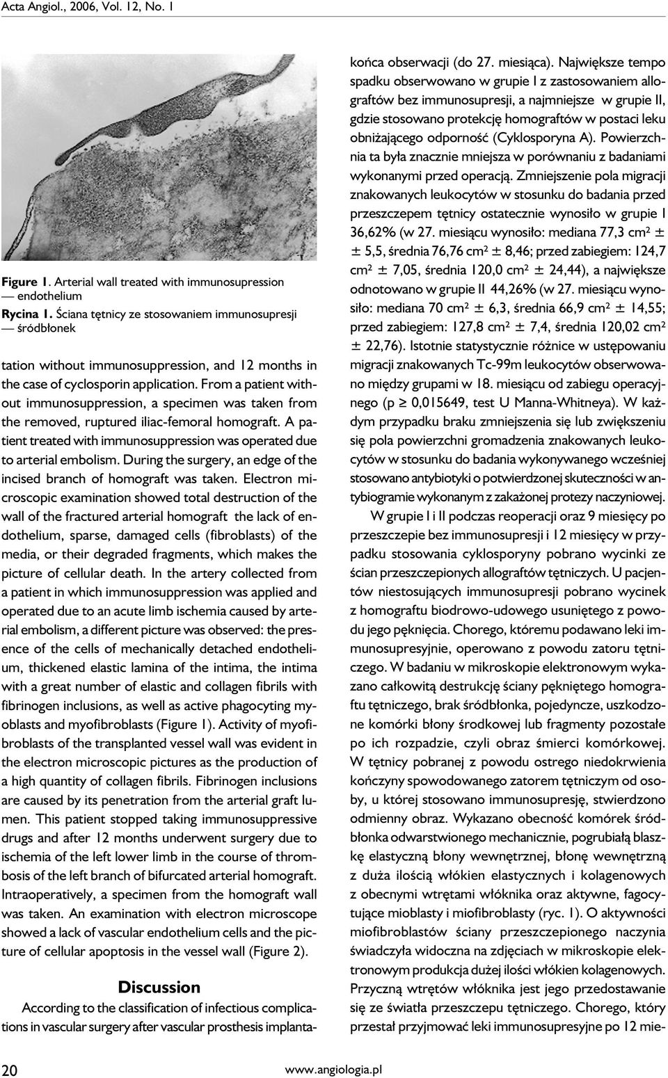 From a patient without immunosuppression, a specimen was taken from the removed, ruptured iliac-femoral homograft. A patient treated with immunosuppression was operated due to arterial embolism.