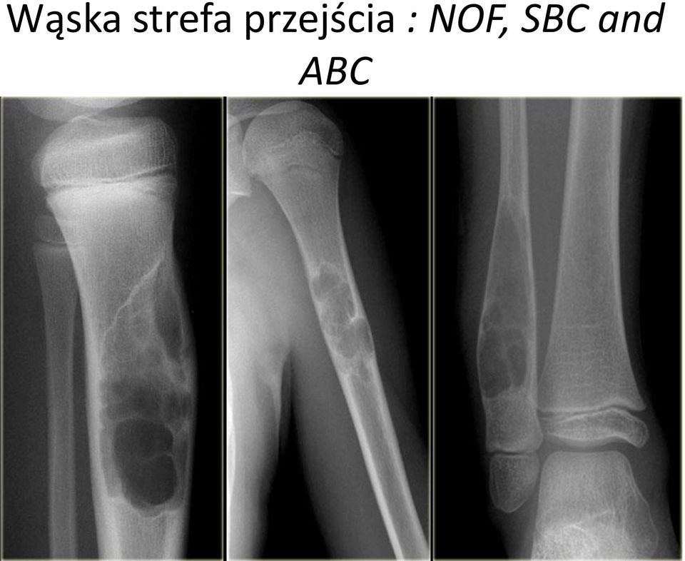 przejścia