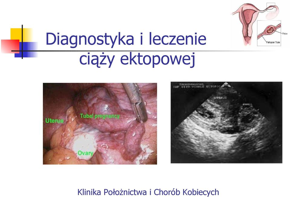 ektopowej Klinika