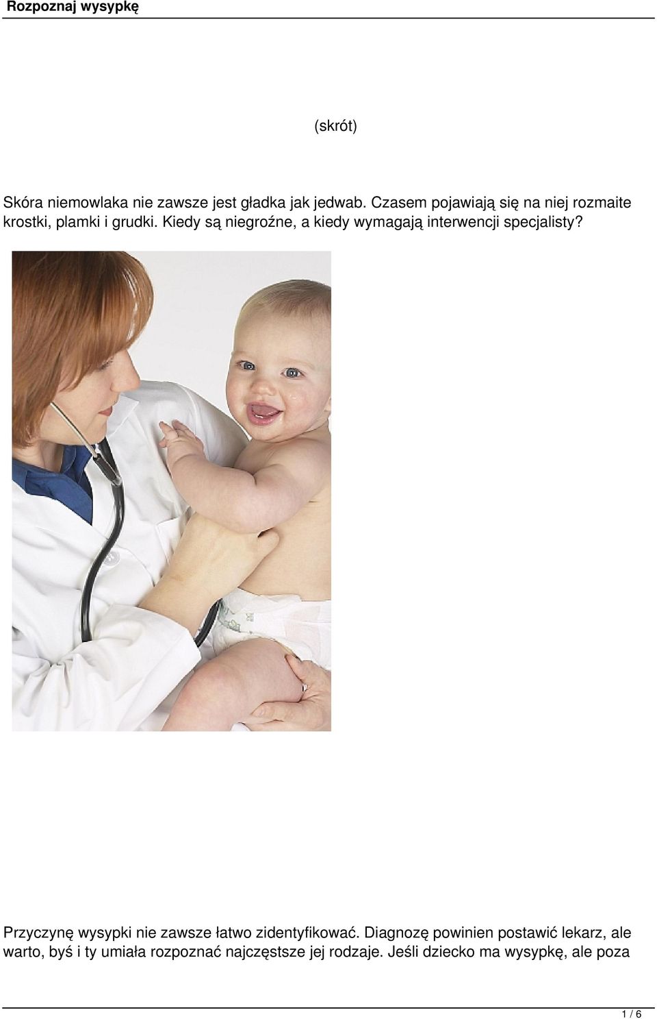 Kiedy są niegroźne, a kiedy wymagają interwencji specjalisty?