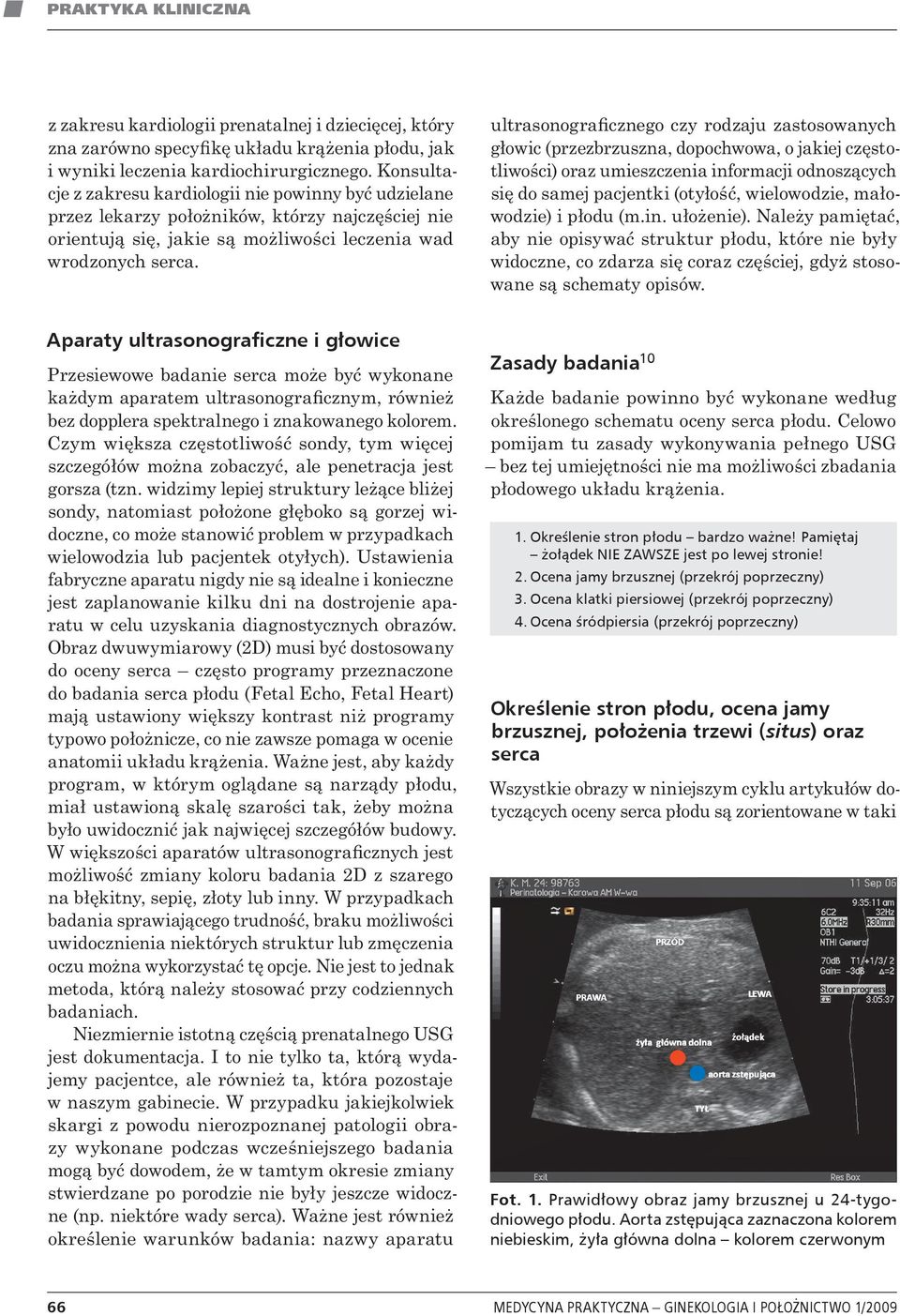 ultrasonograficznego czy rodzaju zastosowanych głowic (przezbrzuszna, dopochwowa, o jakiej częstotliwości) oraz umieszczenia informacji odnoszących się do samej pacjentki (otyłość, wielowodzie,