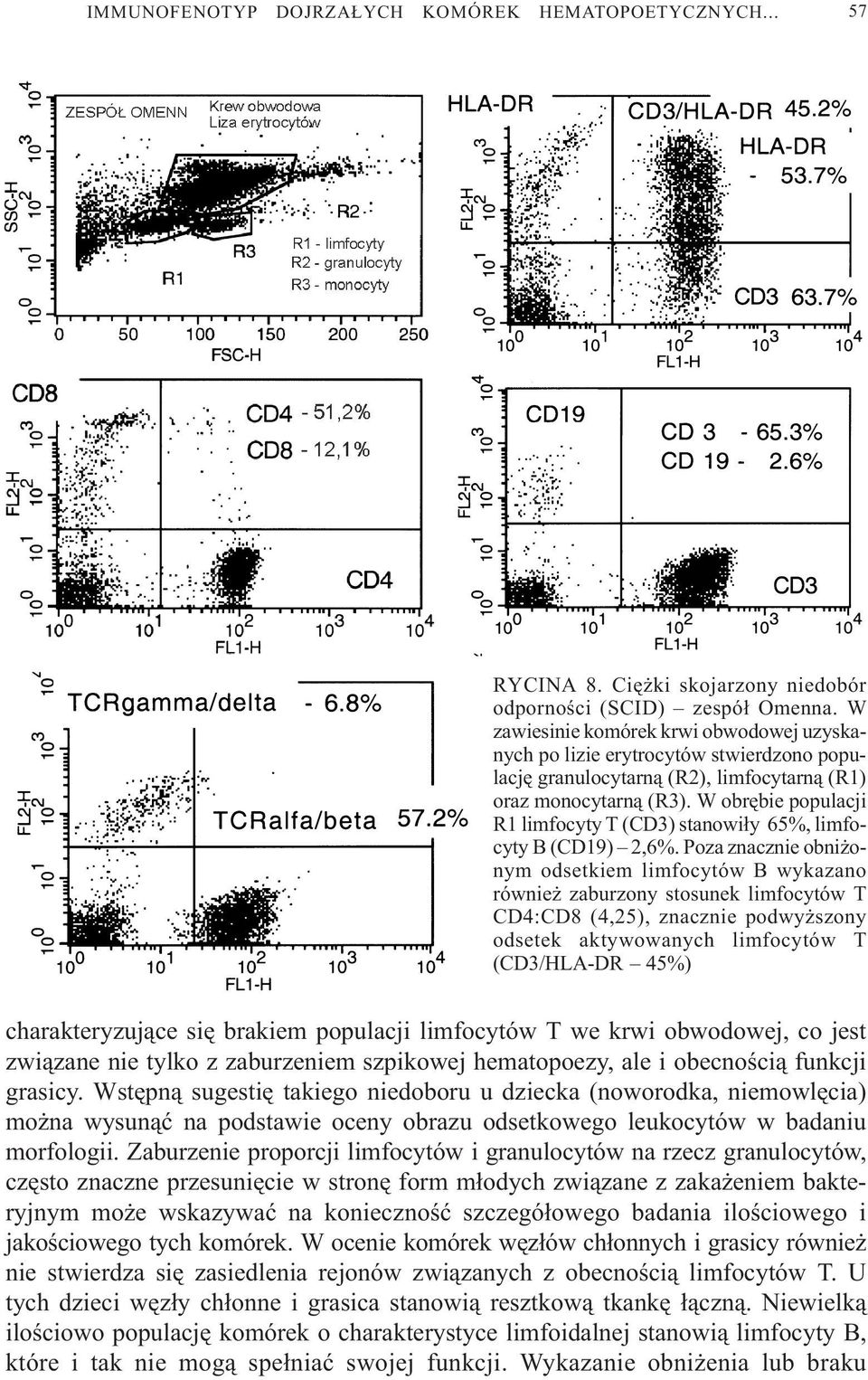 W obrêbie populacji R1 limfocyty T () stanowi³y 65%, limfocyty B (CD19) 2,6%.
